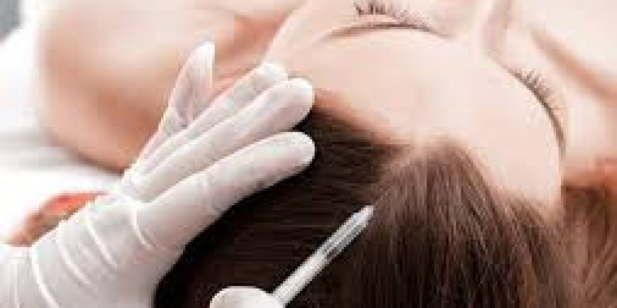 GFC Hair Treatment for Receding Hairline: Natural Regrowth Solution