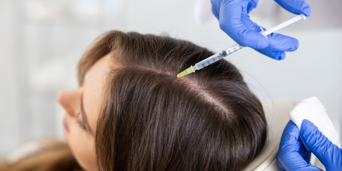 Can Prp Be Combined With Hair Transplant?
