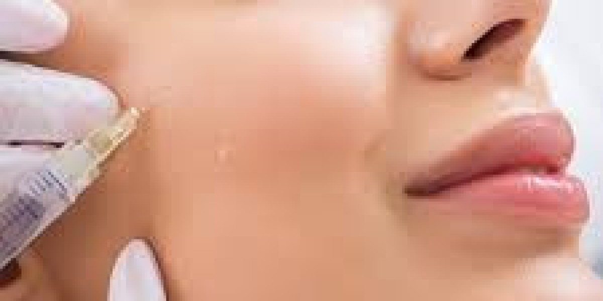 Facial Balance and Beauty Enhancement with Cheek Filler injections in Dubai