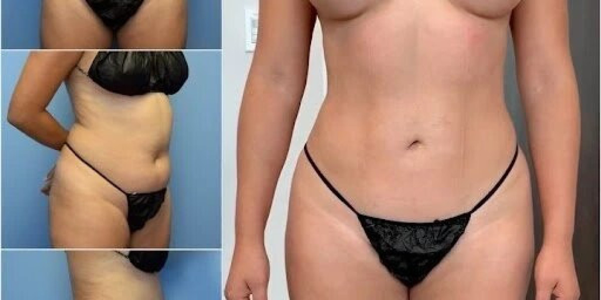 Body Contouring in Dubai: Professional Treatments for Remarkable Results