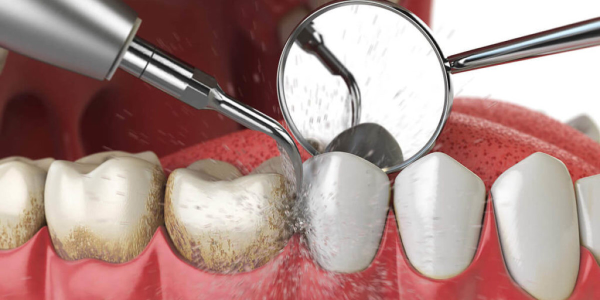Saving Smiles With Preventive Care and Modern Treatments