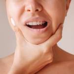 Lower Jaw Surgery Profile Picture