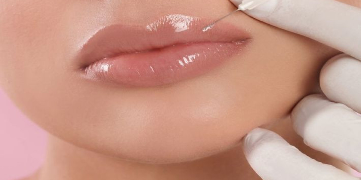 Volbella Fillers For Lip in Dubai for Subtle Beauty Enhancement