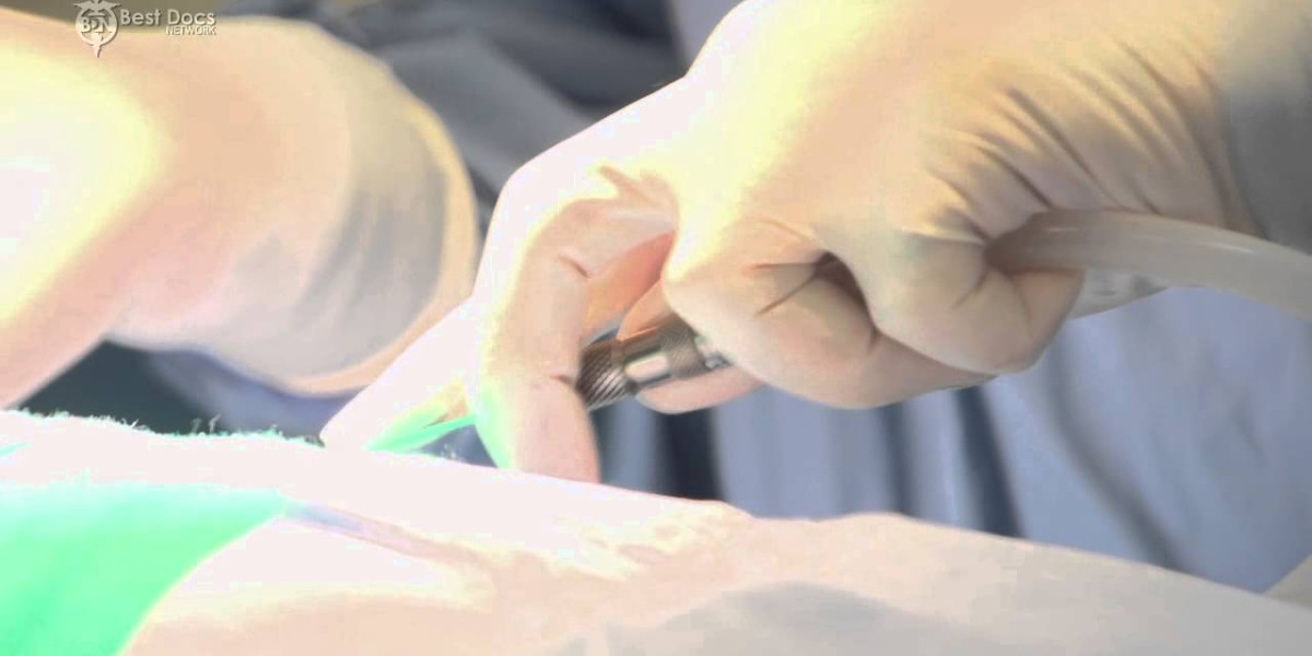 Labiaplasty Surgery in Riyadh and Recovery Timeline