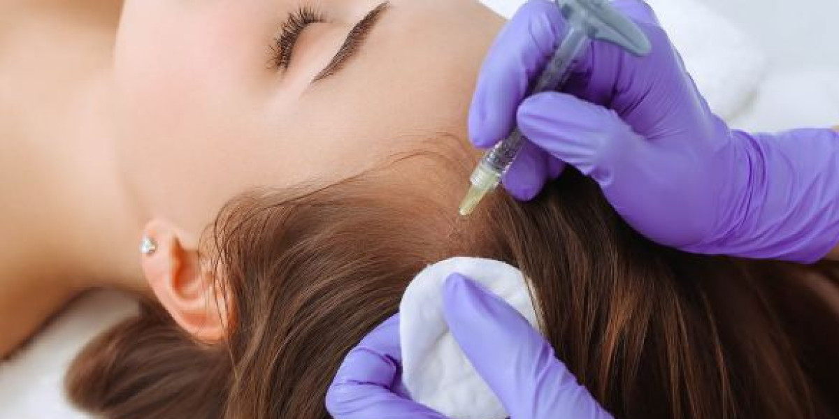 PRP Hair Treatment in Dubai for Female Hair Thinning Guide