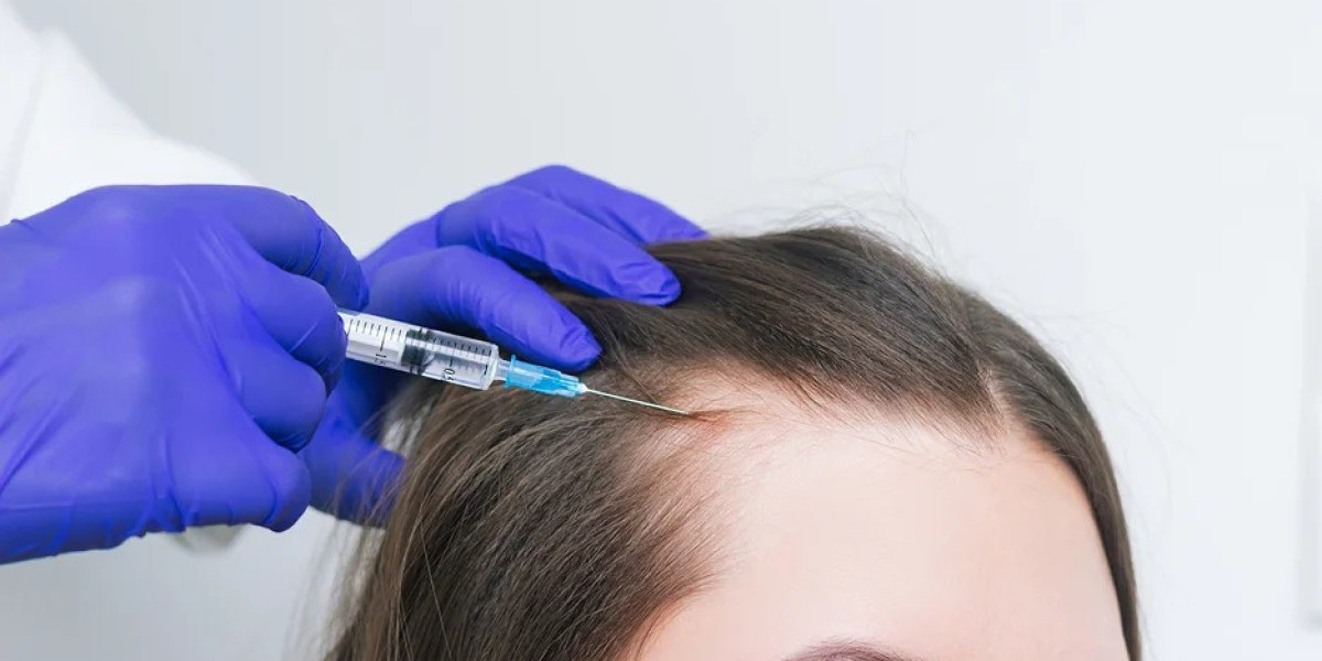 Why Stem Cell Hair Restoration Represents the Future of Hair Loss Treatment