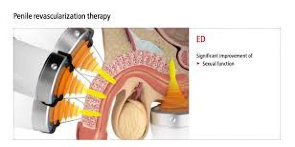 Erectile Dysfunction Treatment in Dubai for Improved Quality of Life