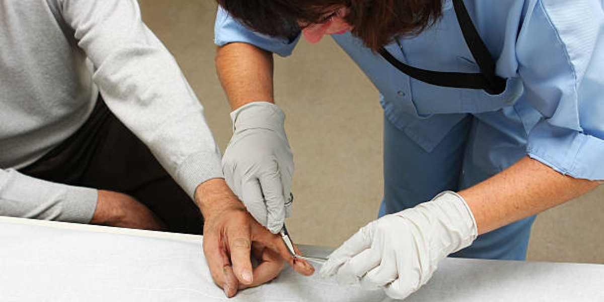 What Doctors Say About Suture Removal at Home