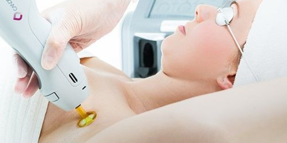 Laser Hair Removal in Dubai: Expert Clinical Advice