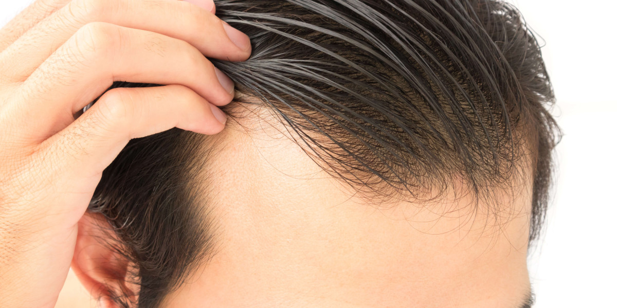 Is Hair Transplant Safe?