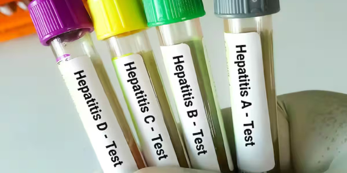 Hepatitis B Test: Can Testing Detect a Hidden Infection?